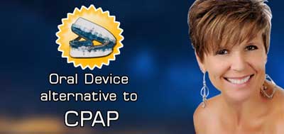 smiling woman and oral device alternative to CPAP image
